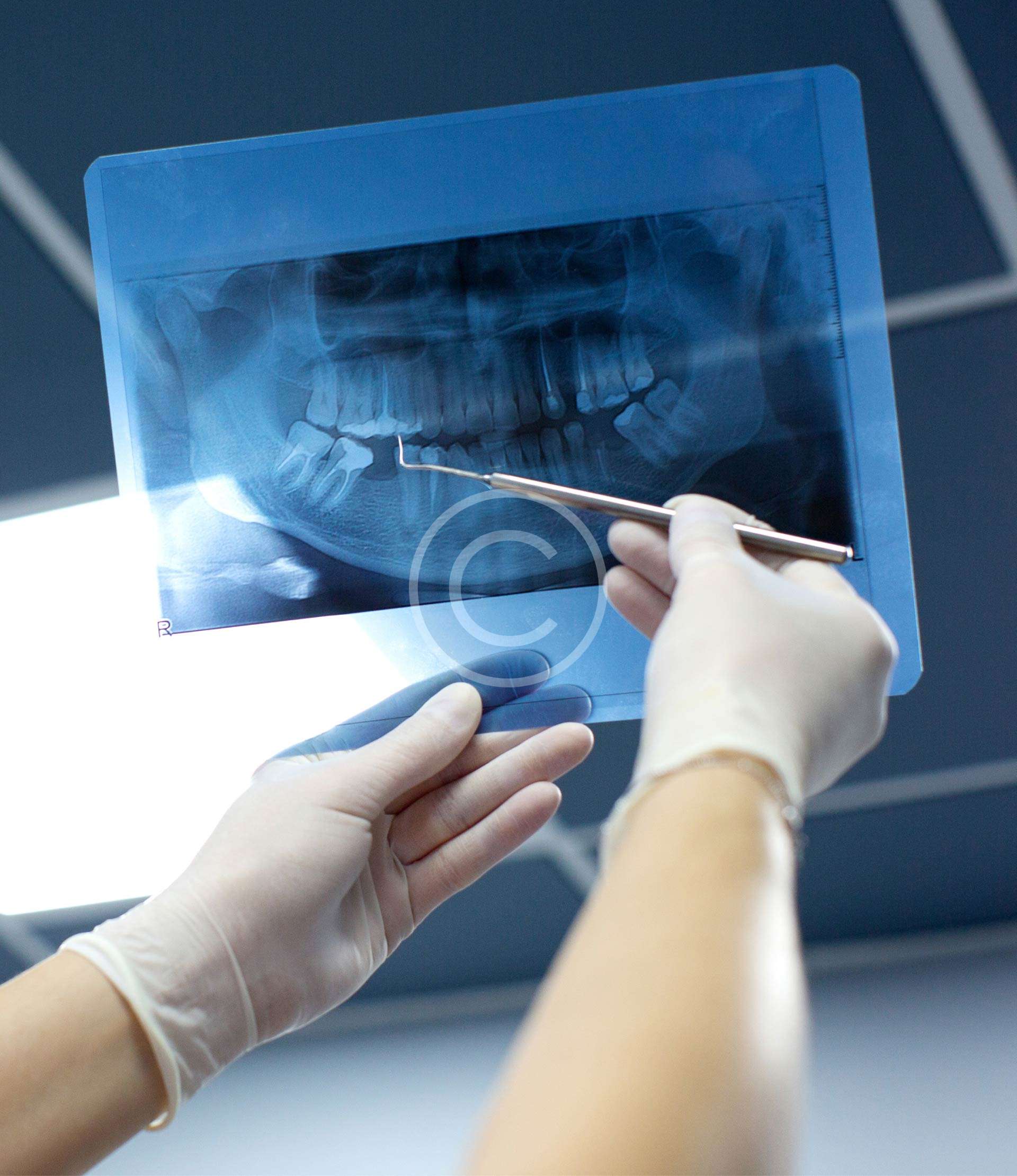 Dental radiography | The Hair Transplant Clinic